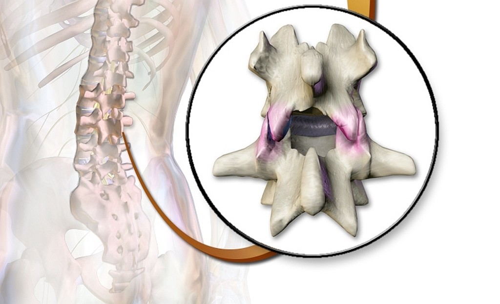 Les chiropraticiens expliquent l'importance de prendre soin des facettes articulaires