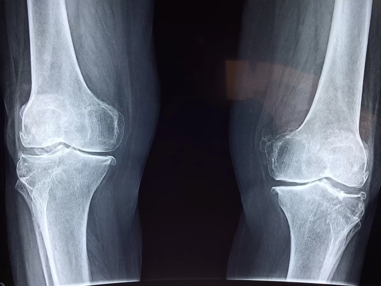 Améliorer la flexibilité et la mobilité : soins chiropratiques pour les problèmes articulaires